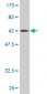 FCER2 Antibody (monoclonal) (M14)