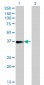 FCER2 Antibody (monoclonal) (M14)