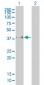 FCGR2B Antibody (monoclonal) (M01)