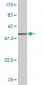 FCGR3A Antibody (monoclonal) (M03)