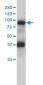 FES Antibody (monoclonal) (M01)