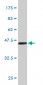 FGF21 Antibody (monoclonal) (M01)