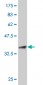 FGF21 Antibody (monoclonal) (M04)