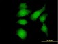 FGFR1OP Antibody (monoclonal) (M01)