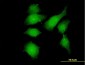 FGFR1OP Antibody (monoclonal) (M01)