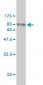 FGFR1OP Antibody (monoclonal) (M01)