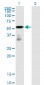 FGFR1OP Antibody (monoclonal) (M01)