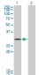 FGFR1OP2 Antibody (monoclonal) (M01)