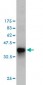 FGG Antibody (monoclonal) (M01)