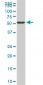 FGL2 Antibody (monoclonal) (M01)