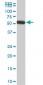 FGL2 Antibody (monoclonal) (M01)