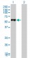 FGL2 Antibody (monoclonal) (M01)