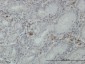 FGL2 Antibody (monoclonal) (M01)
