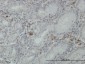 FGL2 Antibody (monoclonal) (M01)