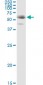 FGL2 Antibody (monoclonal) (M01)