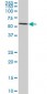 FGL2 Antibody (monoclonal) (M02)