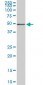 FGL2 Antibody (monoclonal) (M02)