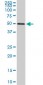 FGL2 Antibody (monoclonal) (M02)