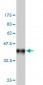 FHIT Antibody (monoclonal) (M03)