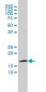 FHIT Antibody (monoclonal) (M03)