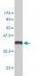 FHIT Antibody (monoclonal) (M07)