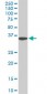 FHL1 Antibody (monoclonal) (M01)