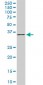 FHL1 Antibody (monoclonal) (M01)