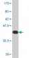 FHL1 Antibody (monoclonal) (M05)