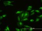 FHL2 Antibody (monoclonal) (M01)