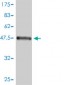 FHL2 Antibody (monoclonal) (M01)