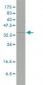 FHL2 Antibody (monoclonal) (M01)