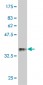 FKBP10 Antibody (monoclonal) (M01)
