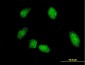 FLI1 Antibody (monoclonal) (M05)