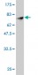 FLI1 Antibody (monoclonal) (M07)