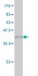 FMR1 Antibody (monoclonal) (M01)