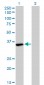 FMR1 Antibody (monoclonal) (M01)