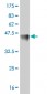 FOSL2 Antibody (monoclonal) (M01)