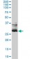 FOSL2 Antibody (monoclonal) (M01)