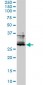 FOSL2 Antibody (monoclonal) (M01)