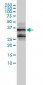 FOSL2 Antibody (monoclonal) (M01)