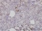 FOXA1 Antibody (monoclonal) (M02)