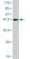 FOXA1 Antibody (monoclonal) (M02)