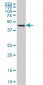 FOXA1 Antibody (monoclonal) (M02)