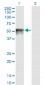 FOXA1 Antibody (monoclonal) (M02)