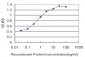 FOXA1 Antibody (monoclonal) (M02)