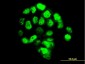 FOXA1 Antibody (monoclonal) (M03)