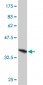 FOXA1 Antibody (monoclonal) (M03)