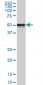 FOXA1 Antibody (monoclonal) (M03)