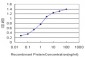 FOXA1 Antibody (monoclonal) (M03)