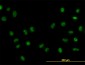 FOXA1 Antibody (monoclonal) (M05)